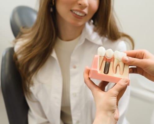 dentist showing the dental implant model
